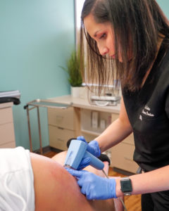 Morpheus8 Radiofrequency Microneedling, Morpheus8 RF Microneedling